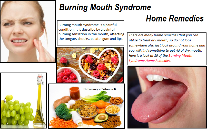 Burning Mouth Syndrome Treatment Natural Burning Mouth Syndrome Treatment Natural