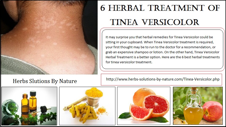 6 Herbal Treatment Of Tinea Versicolor Herbs Solutions By Nature