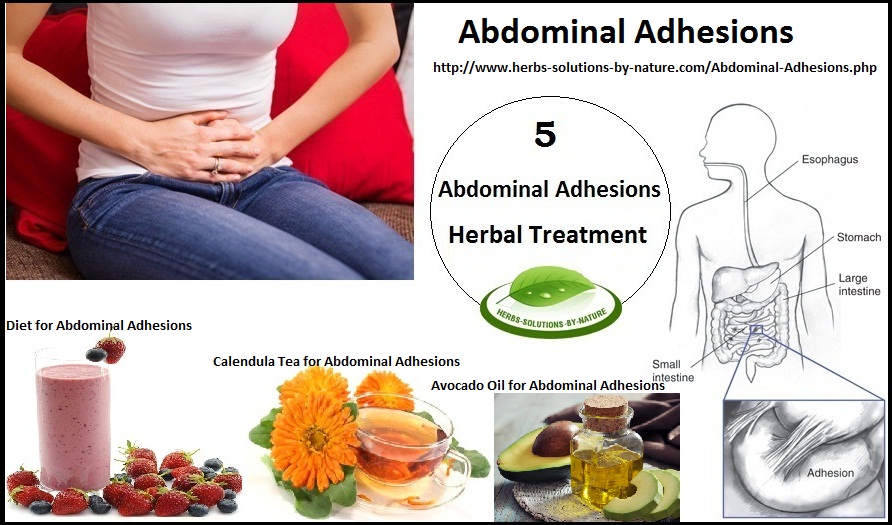 5 Herbal Treatments for Abdominal Adhesions Herbs Solutions By Nature