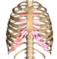 Costochondritis