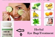Easy and Quick Home Remedies for Eye Bags