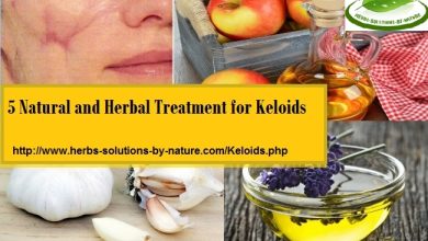 Keloid