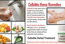 6 Effective Cellulitis Home Remedies
