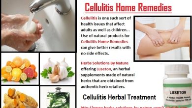 6 Effective Cellulitis Home Remedies