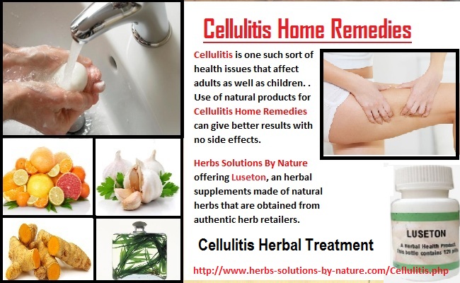 6 Effective Cellulitis Home Remedies