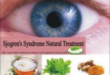 8 Natural Treatment for Sjogren's Syndrome Dry Eyes