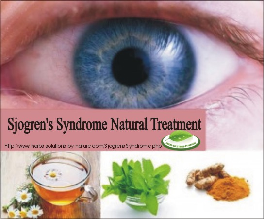 8 Natural Treatment for Sjogren's Syndrome Dry Eyes