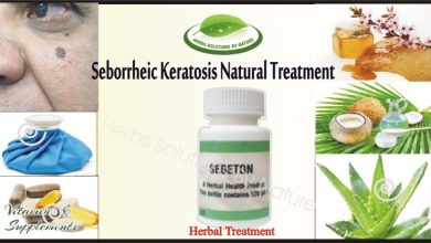 Get Rid From Seborrheic Keratosis with Natural Treatment