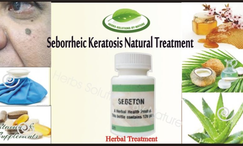 Get Rid From Seborrheic Keratosis with Natural Treatment