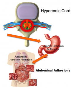 Pregabalin Reduces Abdominal Pain and Improves Sleep in Women with Adhesions