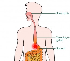 For Achalasia We Should Stick with Conventional Treatment