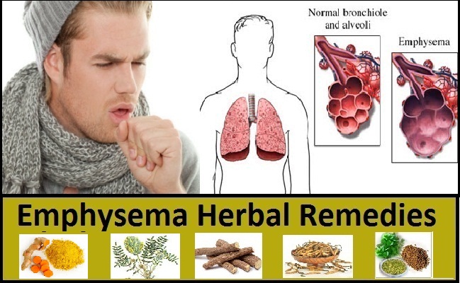 7 Emphysema Herbal Remedies and Hysmeton Herbal Supplements