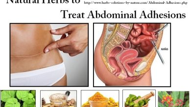 Wonderful Natural Herbs to Treat Abdominal Adhesions Pain