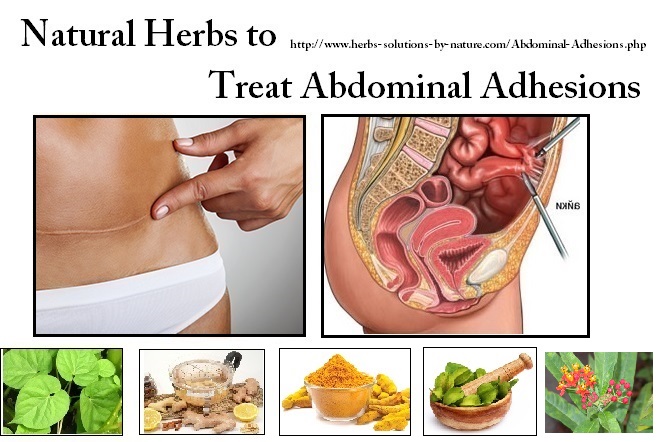 Wonderful Natural Herbs to Treat Abdominal Adhesions Pain
