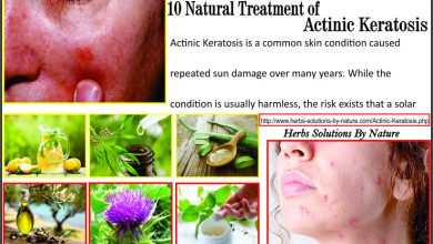 10 Natural Treatment of Actinic Keratosis