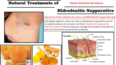 Hidradenitis-Suppurativa