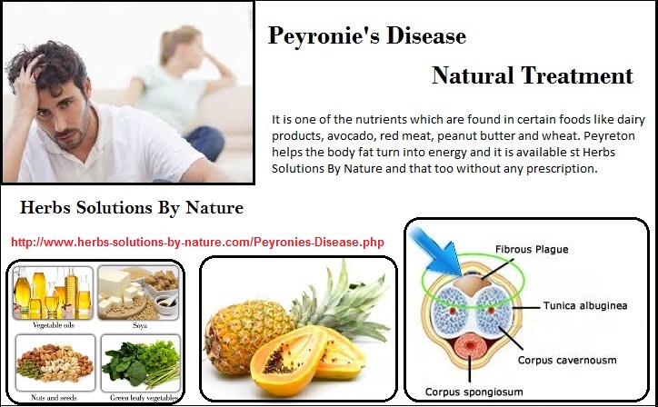 Natural Treatment for Peyronie's Disease starts dissolving your Pe...