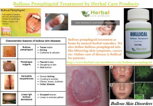 10 Natural Remedies for Bullous Pemphigoid