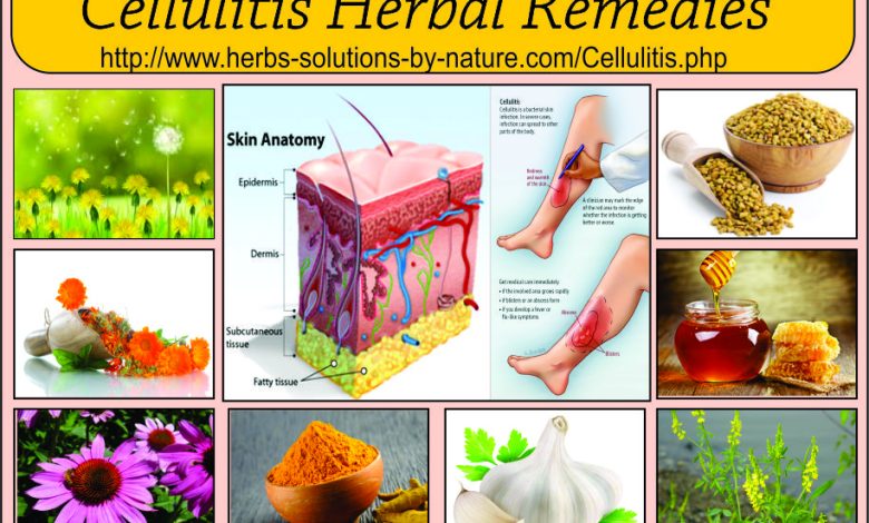 12 Herbal Remedies for Cellulitis Bacterial Skin Infection