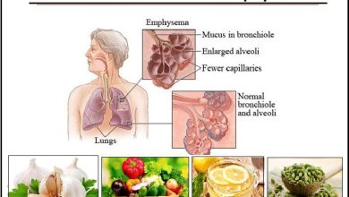 9 Natural Treatments for Emphysema to Recover Lung Function