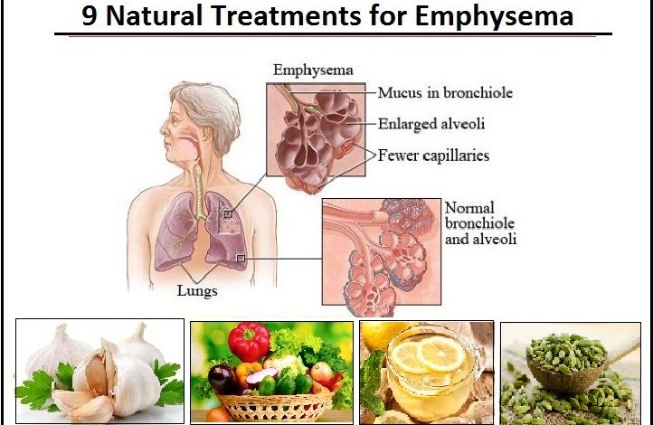 9 Natural Treatments for Emphysema to Recover Lung Function