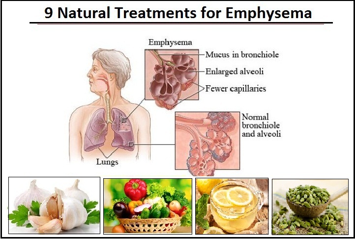 Emphysema Rashes Lichen Planus Rash: Expert-Approved Treatments for Smooth, Healthy Skin ...