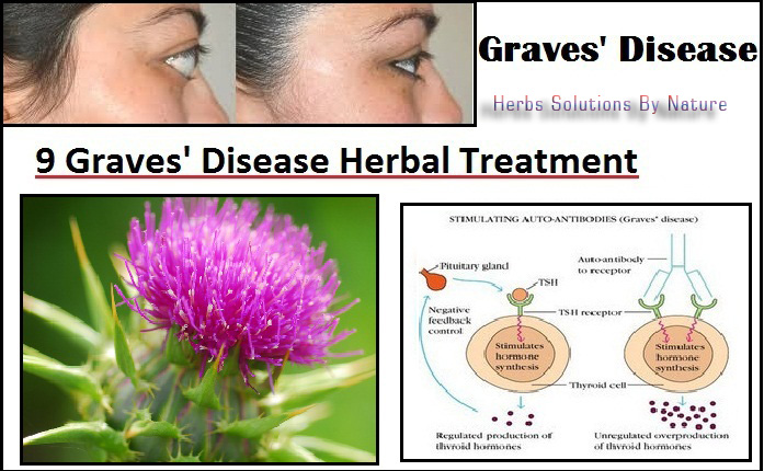 Graves-Disease