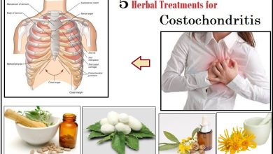 5 Herbal Treatments for Costochondritis Chest Pain