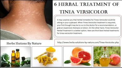 6 Herbal Treatment of Tinea Versicolor