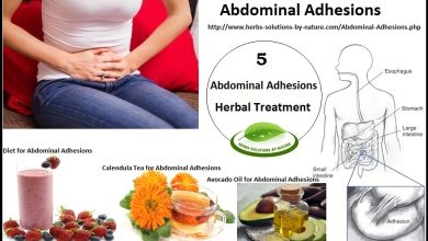 5 Herbal Treatments for Abdominal Adhesions