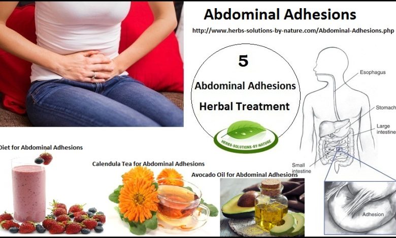 5 Herbal Treatments for Abdominal Adhesions
