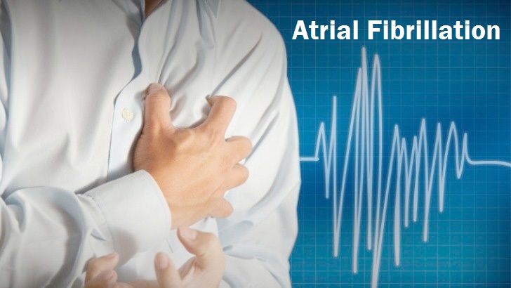 New Research and Treatment for Atrial Fibrillation