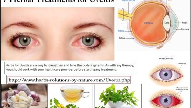 Uveitis