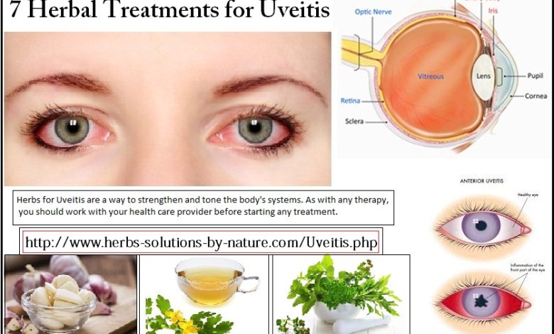 Uveitis