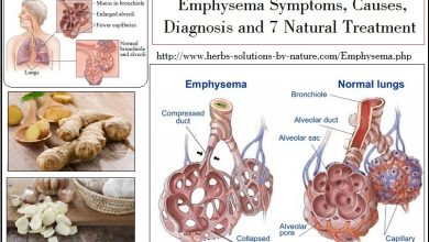 Exclusive Information about Emphysema Symptoms, Causes Diagnosis and Natural Treatment