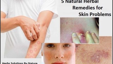 5 Natural Herbal Remedies for Skin Problems