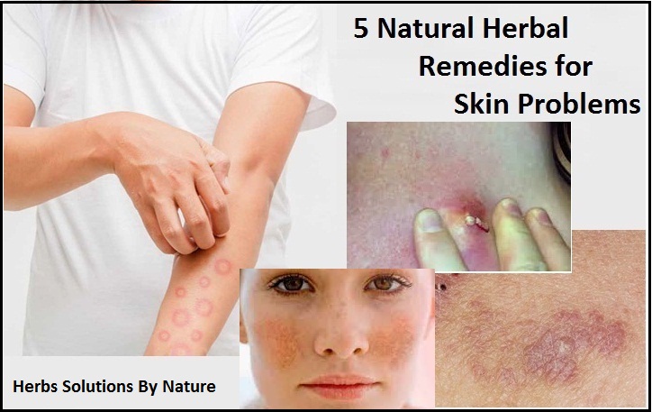 5 Natural Herbal Remedies for Skin Problems
