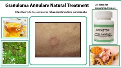 Greneton Herbal Supplement for Granuloma Annulare Natural Treatment