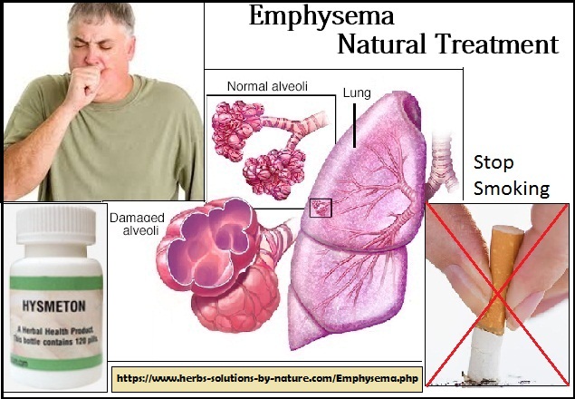 Hysmeton Herbal Supplement for Emphysema Natural Treatment