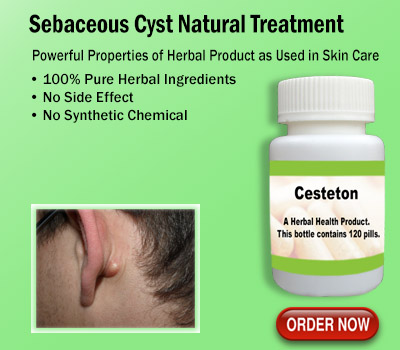 Sebaceous-Cyst-Natural-Treatment