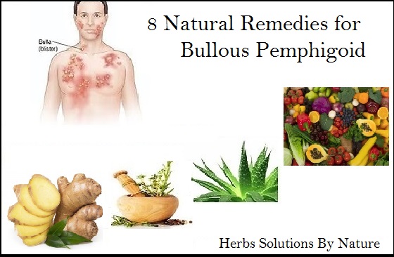 8 Natural Remedies for Bullous Pemphigoid