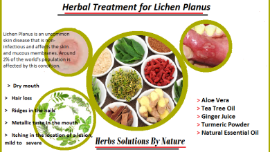 Lichen-Planus-Herbal-Treatment
