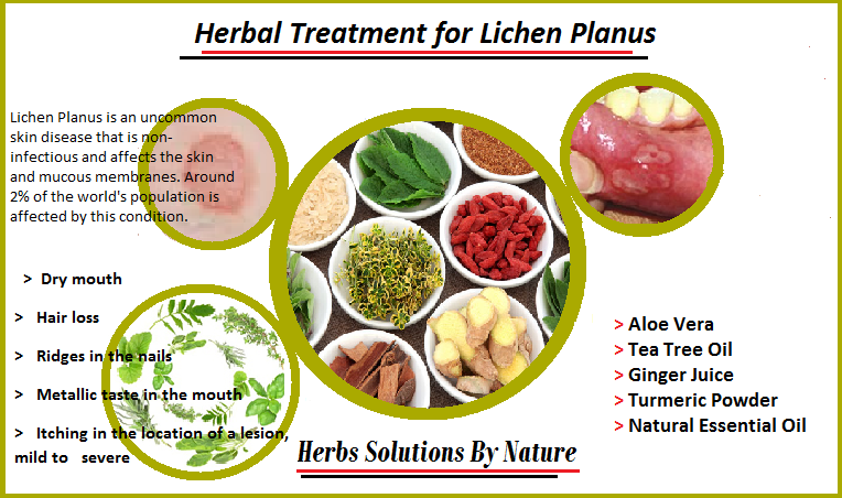 Lichen-Planus-Herbal-Treatment