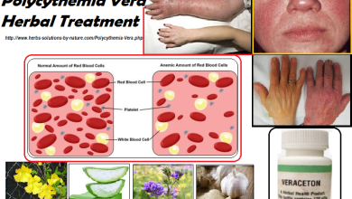Polycythemia-Vera-Natural-Cure