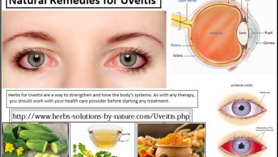 Natural-Remedies-for-Uveitis