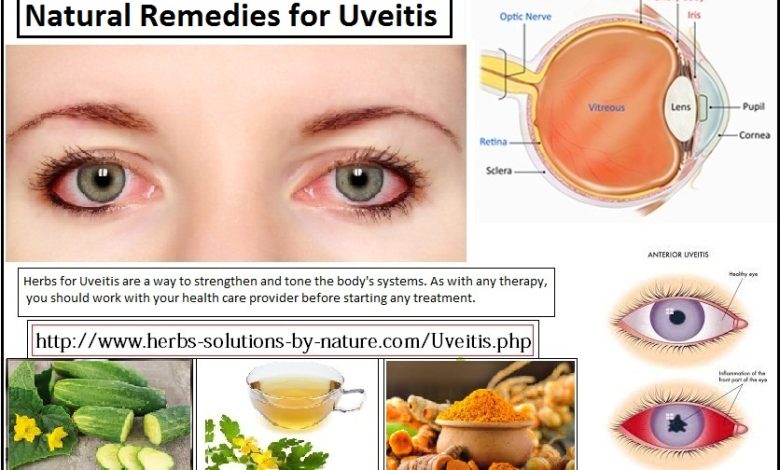 Natural-Remedies-for-Uveitis