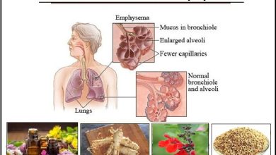 Natural Treatment for Emphysema, Herbs and Natural Essential Oils