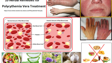 10 Herbal Remedies for Polycythemia Vera Treatment