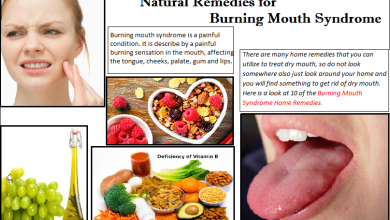 Natural Remedies for Burning Mouth Syndrome and Self-Care Routine