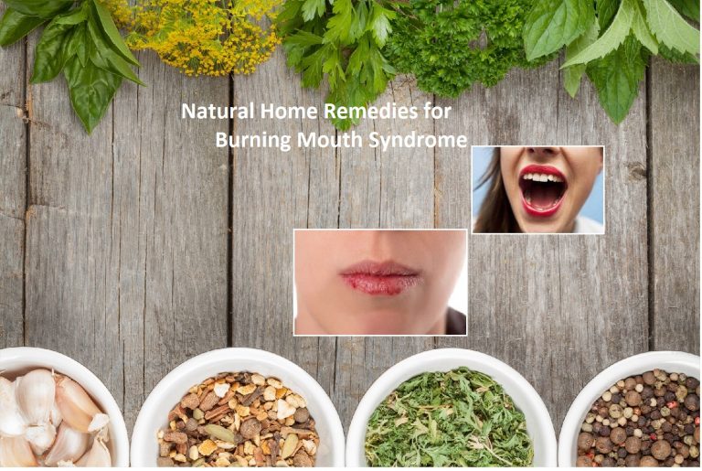 Natural Home Remedies for Burning Mouth Syndrome and Lifestyle Changes
